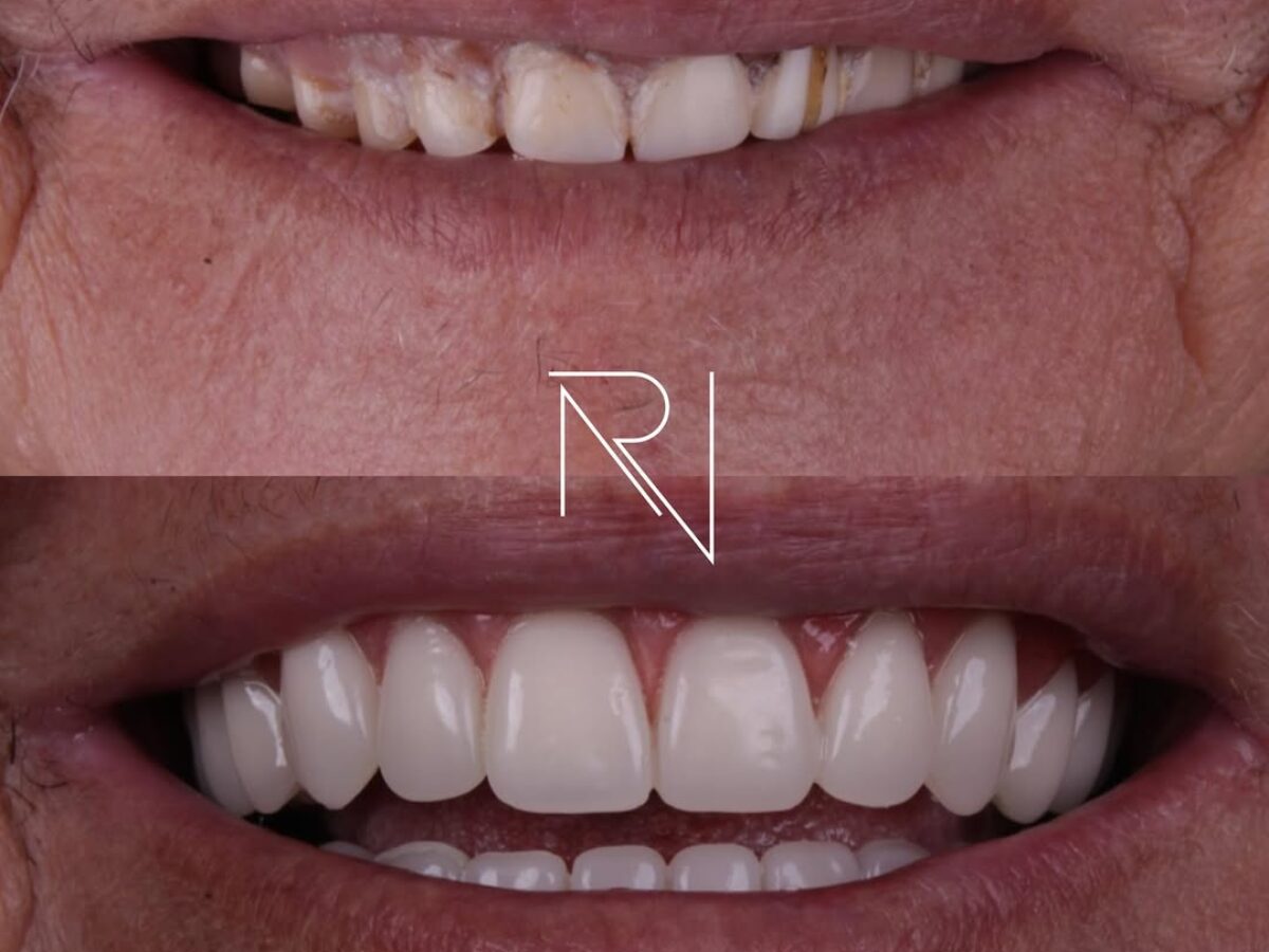 SnapInsta.to_551267094_17984605679889734_5467007539036804022_n